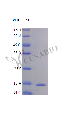 SDS-PAGE CSB-AP001661HU