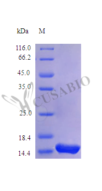 SDS-PAGE CSB-AP001691HU
