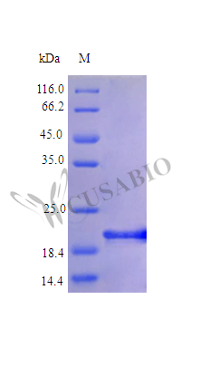 SDS-PAGE CSB-AP001741HU