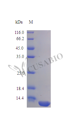 SDS-PAGE CSB-AP001821HU