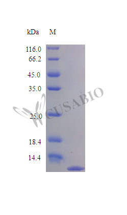 Recombinant Human Tumor necrosis factor receptor superfamily member 12A protein (TNFRSF12A), partial (Active) Recombinant Human Tumor necrosis factor receptor superfamily member 12A protein (TNFRSF12A), partial (Active)