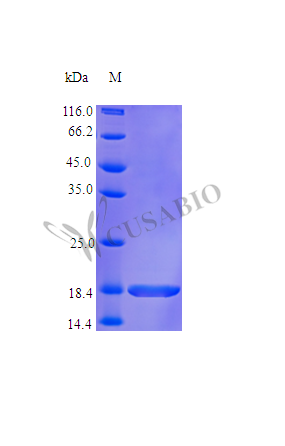 Recombinant Human Aminoacyl tRNA synthase complex-interacting multifunctional protein 1 protein (AIMP1) , partial (Active) - image 1