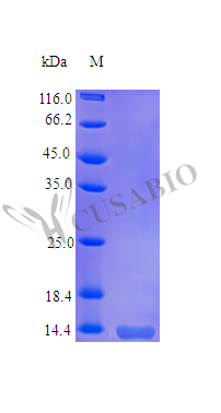 SDS-PAGE- Recombinant protein Human TNFRSF10B