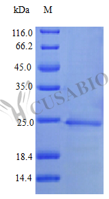 Recombinant Human Interferon alpha-1/13 (IFNA1) (Active) Recombinant Human Interferon alpha-1/13 (IFNA1) (Active)