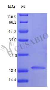 Recombinant Human Interferon alpha-1/13 protein (IFNA1) (Active) Recombinant Human Interferon alpha-1/13 protein (IFNA1) (Active)