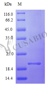Recombinant Human Interferon alpha-2 protein (IFNA2), partial (Active) Recombinant Human Interferon alpha-2 protein (IFNA2), partial (Active)
