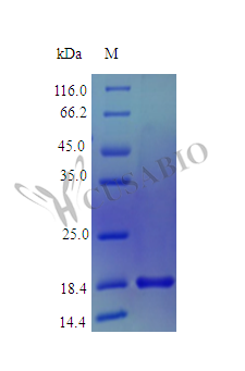 Recombinant Human Mesencephalic astrocyte-derived neurotrophic factor protein (MANF) (Active) Recombinant Human Mesencephalic astrocyte-derived neurotrophic factor protein (MANF) (Active)