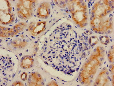 Immunohistochemistry of paraffin-embedded human kidney tissue using CSB-PA00135A0Rb at dilution of 1:100