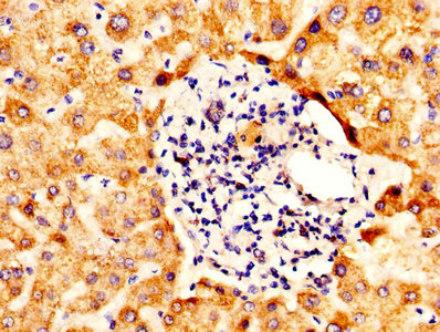 IHC image of CSB-PA001577LA01HU diluted at 1:400 and staining in paraffin-embedded human liver tissue performed on a Leica BondTM system. After dewaxing and hydration, antigen retrieval was mediated by high pressure in a citrate buffer (pH 6.0). Section was blocked with 10% normal goat serum 30min at RT. Then primary antibody (1% BSA) was incubated at 4°C overnight. The primary is detected by a biotinylated secondary antibody and visualized using an HRP conjugated SP system.