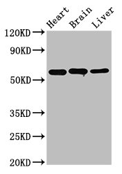 Western Blot Positive WB detected in: Rat heart tissue, Rat brain tissue, Mouse liver tissue All lanes: ALDH5A1 antibody at 3.2microg/ml Secondary Goat polyclonal to rabbit IgG at 1/50000 dilution Predicted band size: 58, 59 kDa Observed band size: 58 kDa Western Blot Positive WB detected in: Rat heart tissue, Rat brain tissue, Mouse liver tissue All lanes: ALDH5A1 antibody at 3.2microg/ml Secondary Goat polyclonal to rabbit IgG at 1/50000 dilution Predicted band size: 58, 59 kDa Observed band size: 58 kDa