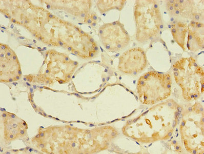 Immunohistochemistry of paraffin-embedded human kidney tissue using CSB-PA001935EA01HU at dilution of 1:100