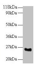 Western blot All lanes: SRSF9 antibody at 2microg/ml + Mouse kidney tissue Secondary Goat polyclonal to rabbit IgG at 1/10000 dilution Predicted band size: 26 kDa Observed band size: 26 kDa Western blot All lanes: SRSF9 antibody at 2microg/ml + Mouse kidney tissue Secondary Goat polyclonal to rabbit IgG at 1/10000 dilution Predicted band size: 26 kDa Observed band size: 26 kDa