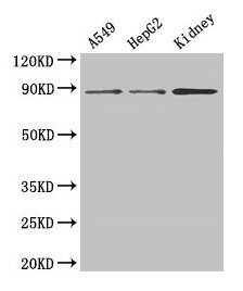 Western Blot Positive WB detected in: A549 whole cell lysate, HepG2 whole cell lysate, Mouse kidney tissue All lanes: ASPH antibody at 3microg/ml Secondary Goat polyclonal to rabbit IgG at 1/50000 dilution Predicted band size: 86, 35, 26, 24, 34, 84, 30, 22, 29, 33 kDa Observed band size: 86 kDa
