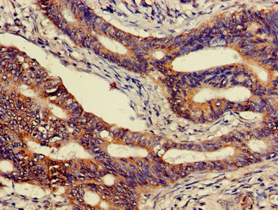 CSB-PA005167LA01HU