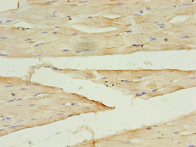 Immunohistochemistry of paraffin-embedded human skeletal muscle tissue using CSB-PA006500EA01HU at dilution of 1:100