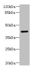 Western blot All lanes: DCX antibody at 8microg/ml + Mouse brain tissue Secondary Goat polyclonal to rabbit IgG at 1/10000 dilution Predicted band size: 41 kDa Observed band size: 41 kDa
