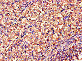 Immunohistochemistry of paraffin-embedded human ovarian tissue using CSB-PA006580LA01HU at dilution of 1:100