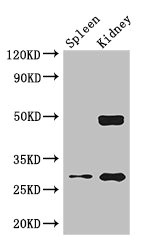 Western Blot Positive WB detected in: Mouse lung tissue, Mouse kidney tissue All lanes: DDAH2 antibody at 2.5ug/ml Secondary Goat polyclonal to rabbit IgG at 1/50000 dilution Predicted band size: 30 kDa Observed band size: 30, 50 kDa