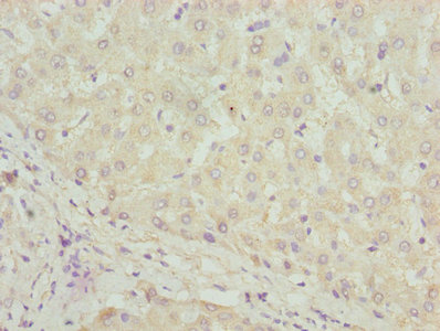 Immunohistochemistry of paraffin-embedded human liver tissue using CSB-PA006860LA01HU at dilution of 1:100