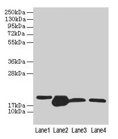 Western blot All lanes: DHRS3 antibody at 0.8microg/ml Lane 1: A375 whole cell lysate Lane 2: Mouse liver tissue Lane 3: Mouse spleen tissue Lane 4: HL60 whole cell lysate Secondary Goat polyclonal to rabbit IgG at 1/10000 dilution Predicted band size: 34, 19 kDa Observed band size: 19 kDa