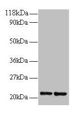 Western blot All lanes: RPS9 antibody at 2microg/ml Lane 1: 293T whole cell lysate Lane 2: EC109 whole cell lysate Secondary Goat polyclonal to rabbit IgG at 1/15000 dilution Predicted band size: 21 kDa Observed band size: 21 kDa