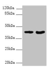 Western blot All lanes: DMKN antibody at 6microg/ml Lane 1: Mouse kidney tissue Lane 2: Mouse liver tissue Secondary Goat polyclonal to rabbit IgG at 1/10000 dilution Predicted band size: 48, 16, 37, 46, 39, 42, 36, 21, 19, 17, 15, 10, 47 kDa Observed band size: 42 kDa