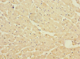 Immunohistochemistry of paraffin-embedded human heart tissue using CSB-PA006982LA01HU at dilution of 1:100