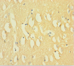 Immunohistochemistry of paraffin-embedded human brain tissue using CSB-PA007062LA01HU at dilution of 1:100
