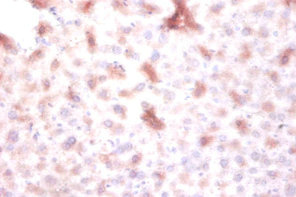 Immunohistochemistry of paraffin-embedded mouse liver tissue using CSB-PA007219EA01HU at dilution of 1:100 Immunohistochemistry of paraffin-embedded mouse liver tissue using CSB-PA007219EA01HU at dilution of 1:100