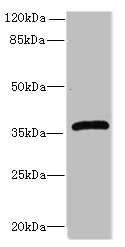 Western blot All lanes: Efnb3 antibody at 12microg/ml + HepG2 whole cell lysate Secondary Goat polyclonal to rabbit IgG at 1/10000 dilution Predicted band size: 36 kDa Observed band size: 36 kDa Western blot All lanes: Efnb3 antibody at 12microg/ml + HepG2 whole cell lysate Secondary Goat polyclonal to rabbit IgG at 1/10000 dilution Predicted band size: 36 kDa Observed band size: 36 kDa