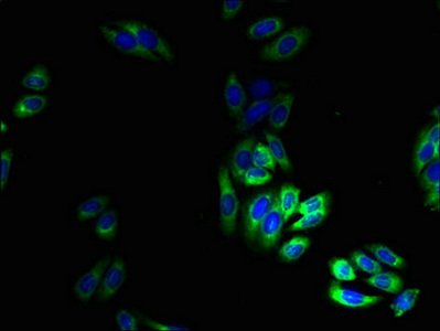 Immunofluorescent analysis of HepG2 cells using CSB-PA007779LA01HU at dilution of 1:100 and Alexa Fluor 488-congugated AffiniPure Goat Anti-Rabbit IgG(H+L)