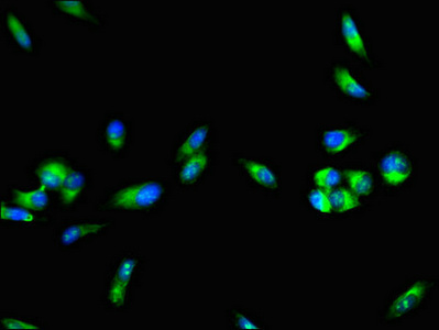 Immunofluorescence(IF) - F8 Antibody