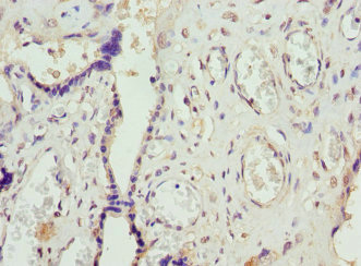 Immunohistochemistry of paraffin-embedded human placenta tissue using CSB-PA008545EA01HU at dilution of 1:100