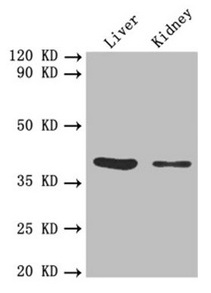 Western blot All lanes: FCGRT antibody at 5.3microg/ml Lane 1: Mouse liver tissue Lane 2: Mouse kidney tissue Secondary Goat polyclonal to rabbit IgG at 1/10000 dilution Predicted band size: 40 kDa Observed band size: 40 kDa