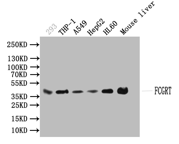 Western blot All lanes: FCGRT antibody at 2microg/ml Lane 1: HepG2 whole cell lysate Lane 2: Mouse liver tissue Lane 3: A549 whole cell lysate Secondary Goat polyclonal to rabbit IgG at 1/10000 dilution Predicted band size: 40 kDa Observed band size: 40 kDa Western blot All lanes: FCGRT antibody at 2microg/ml Lane 1: HepG2 whole cell lysate Lane 2: Mouse liver tissue Lane 3: A549 whole cell lysate Secondary Goat polyclonal to rabbit IgG at 1/10000 dilution Predicted band size: 40 kDa Observed band size: 40 kDa