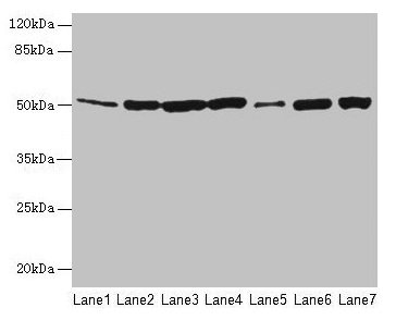 Western blot All lanes: FH antibody at 12microg/ml Lane 1: Mouse heart tissue Lane 2: Mouse liver tissue Lane 3: Mouse kidney tissue Lane 4: Mouse brain tissue Lane 5: Human placenta tissue Lane 6: Hela whole cell lysate Lane 7: HepG2 whole cell lysate Secondary Goat polyclonal to rabbit IgG at 1/10000 dilution Predicted band size: 55, 51 kDa Observed band size: 51 kDa