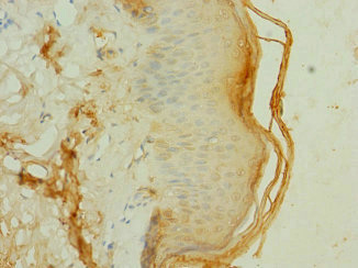 Immunohistochemistry of paraffin-embedded human skin tissue using CSB-PA009005LA01HU at dilution of 1:100