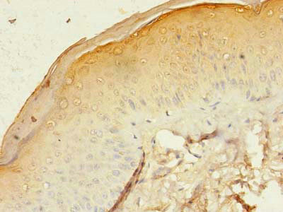 Immunohistochemistry of paraffin-embedded human skin tissue using CSB-PA009453LA01HU at dilution of 1:100