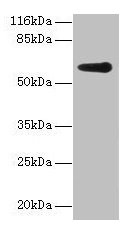 Western Blotting(WB) - GK2 Antibody