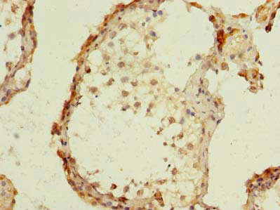 Immunohistochemistry of paraffin-embedded human testis tissue using CSB-PA009829LA01HU at dilution of 1:100