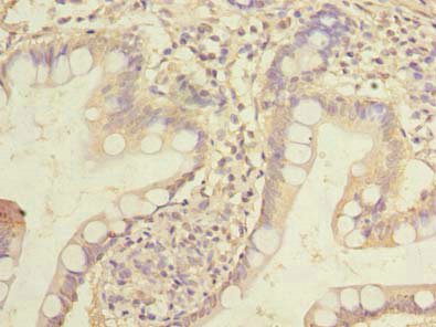 Immunohistochemistry of paraffin-embedded human small intestine tissue using CSB-PA010672LA01HU at dilution of 1:100 Immunohistochemistry of paraffin-embedded human small intestine tissue using CSB-PA010672LA01HU at dilution of 1:100
