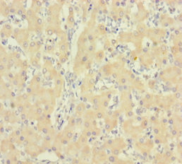 Immunohistochemistry of paraffin-embedded human liver tissue using CSB-PA010997LA01HU at dilution of 1:100 Immunohistochemistry of paraffin-embedded human liver tissue using CSB-PA010997LA01HU at dilution of 1:100