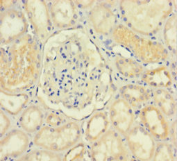 Immunohistochemistry of paraffin-embedded human kidney tissue using CSB-PA010997LA01HU at dilution of 1:100