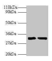 Western blot All lanes: IL-33 antibody at 2microg/ml Lane 1: Hela whole cell lysate Lane 2: Mouse lung tissue Secondary Goat polyclonal to rabbit IgG at 1/10000 dilution Predicted band size: 32 kDa Observed band size: 32 kDa Western blot All lanes: IL-33 antibody at 2microg/ml Lane 1: Hela whole cell lysate Lane 2: Mouse lung tissue Secondary Goat polyclonal to rabbit IgG at 1/10000 dilution Predicted band size: 32 kDa Observed band size: 32 kDa