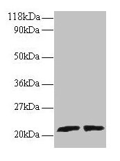 Western blot All lanes: ARL2 antibody at 2microg/ml Lane 1: EC109 whole cell lysate Lane 2: 293T whole cell lysate Secondary Goat polyclonal to rabbit IgG at 1/15000 dilution Predicted band size: 21, 19 kDa Observed band size: 21 kDa