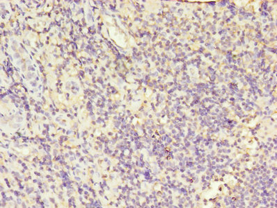 Immunohistochemistry of paraffin-embedded human tonsil tissue using CSB-PA012824YA01HU at dilution of 1:100