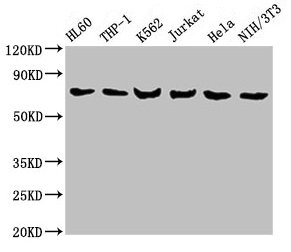Western Blot Positive WB detected in: HL60 whole cell lysate, THP-1 whole cell lysate, K562 whole cell lysate, Jurkat whole cell lysate, Hela whole cell lysate, NIH/3T3 whole cell lysate All lanes: LCP1 antibody at 8microg/ml Secondary Goat polyclonal to rabbit IgG at 1/10000 dilution Predicted band size: 71, 22 kDa Observed band size: 71 kDa
