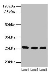 Western blot All lanes: LIN7A antibody at 6microg/ml Lane 1: Human placenta tissue Lane 2: Mouse kidney tissue Lane 3: Mouse liver tissue Secondary Goat polyclonal to rabbit IgG at 1/10000 dilution Predicted band size: 26 kDa Observed band size: 26 kDa