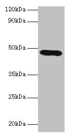 Western blot All lanes: Lox antibody at 2microg/ml + K562 whole cell lysate Secondary Goat polyclonal to rabbit IgG at 1/10000 dilution Predicted band size: 47 kDa Observed band size: 47 kDa