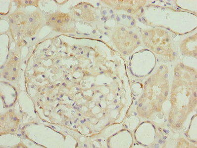 Immunohistochemistry of paraffin-embedded human kidney tissue using CSB-PA013183LA01HU at dilution of 1:100